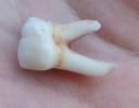 Audreyâ€™s tooth